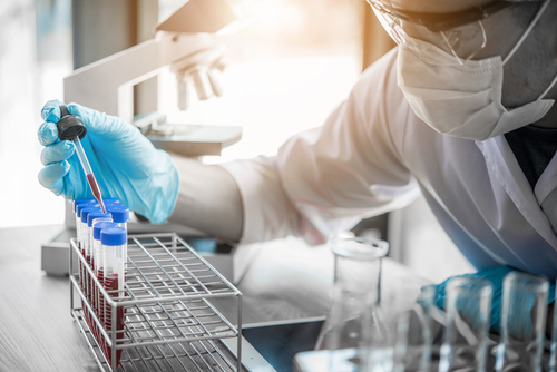 Picture of a lab tech putting blood samples in test tubes.